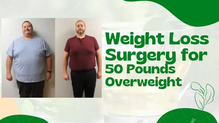 weight loss surgery for 50 pounds overweight