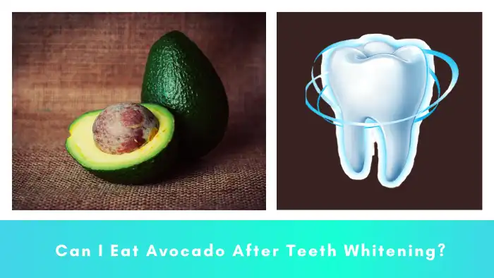 Can I Eat Avocado After Teeth Whitening