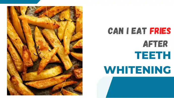 Can I Eat Fries after Teeth Whitening