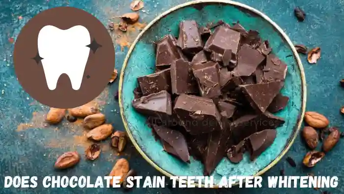 Does Chocolate Stain Teeth After Whitening