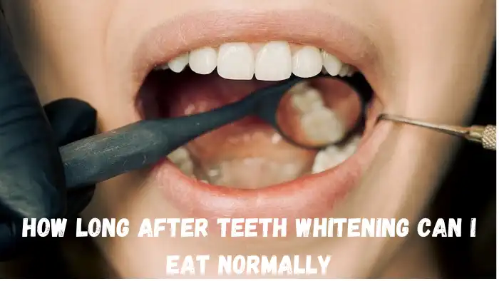 How Long After Teeth Whitening Can I Eat Normally