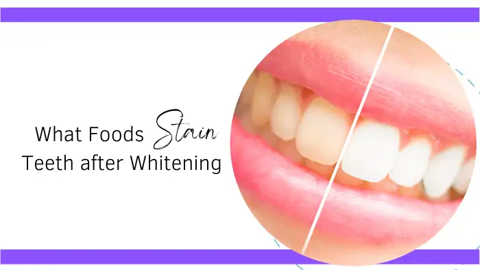 What Foods Stain Teeth after Whitening