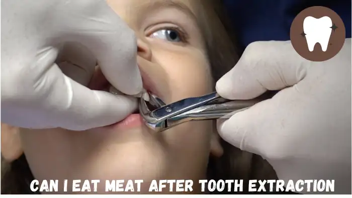 When Can I Eat Meat after Tooth Extraction