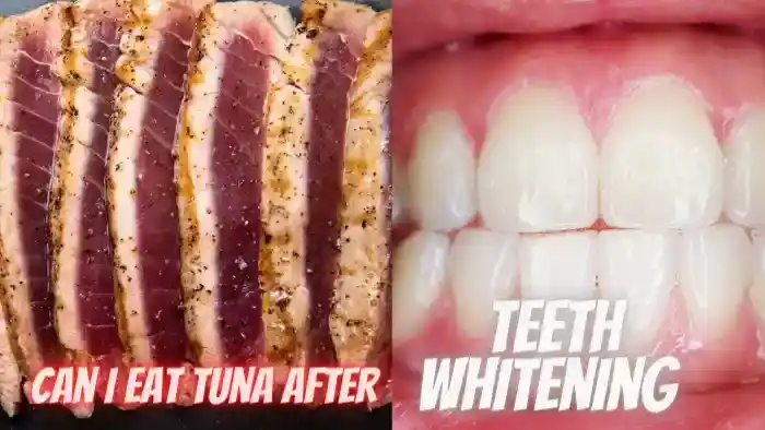 can i eat tuna after teeth whitening