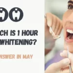 How Much Is 1 Hour Teeth Whitening?