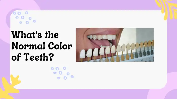 What's the Normal Color of Teeth